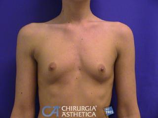 Caso 15, antes
