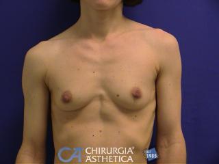 Caso 31, antes