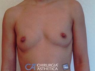 Caso 40, antes