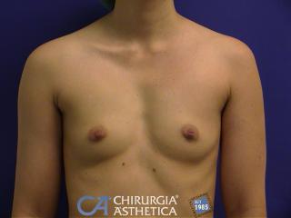 Caso 55, antes