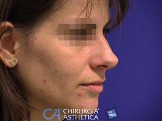 Case 16, before
