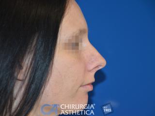 Case 3, before