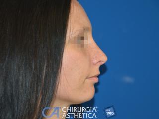 Case 3, after