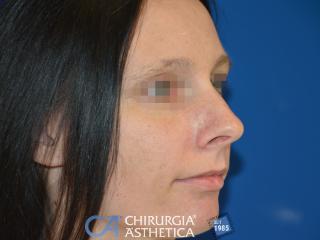 Case 4, before