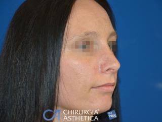 Case 4, after