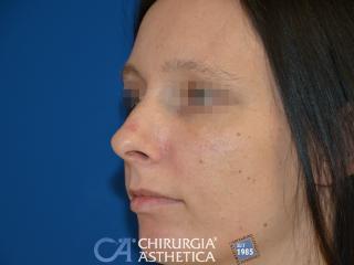 Case 5, before