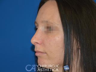 Case 5, after