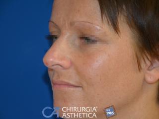 Case 7, before