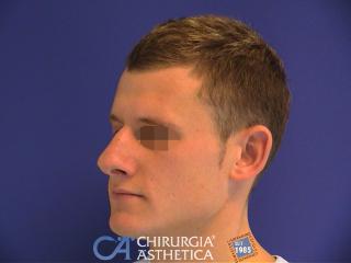 Case 8, before