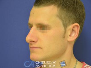 Case 8, after