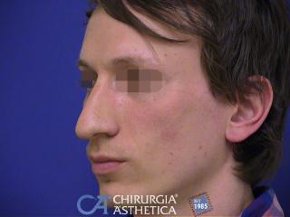 Case 9, before